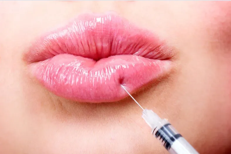 ¿Pensando en usar rellenos durante la menopausia? Esto es lo que tenés que saber (Lo bueno, lo malo y lo importante)